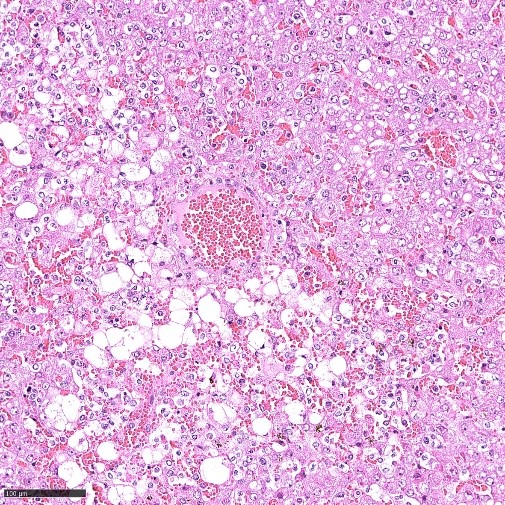 Abbildung 1: Leber eines Frettchens nach Infektion mit Reston Ebolavirus. Neben einer akuten Stauungshyperämie ist eine Lipidose der Leberzellen zu sehen. Zahlreichen Leberzellen sind nekrotisch oder zeigen degenerative Veränderungen.  Hämatoxylin-Eosin-Färbung, Maßstabsbalken 100µm