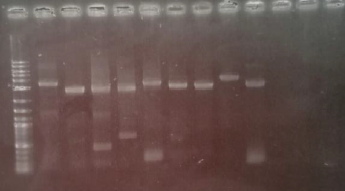 PCR-Produkte aufgetragen im Agarosegel.