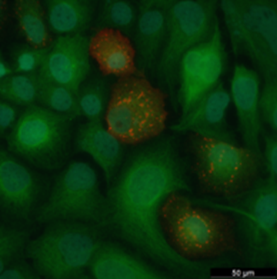 Immunfloureszenzfärbung des endogenen Wirtszellproteins CKAP2 (grün) und des EBOV-NPs (rot), welches gut sichtbare Einschlusskörperchen bildet.