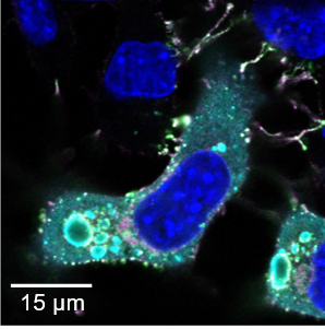 Infektion von Neuroblastomzellen mit RABV Dog A.