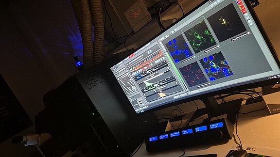 Infektion und Transfektion von Neuroblastomzellen mit einem attenuierten Rabiesvirus unter dem konfokalen Laserscanning-Mikroskop, Blau: Zellkern; Grün: Virus exprimiertes UnaG; Gelb: zelluläres PDZ-Protein; Rot: virales Nukleoprotein (Foto: Tim Schens)