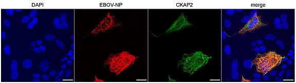 Zelluläre Lokalisation von CKAP2 und dem Nukleoprotein NP