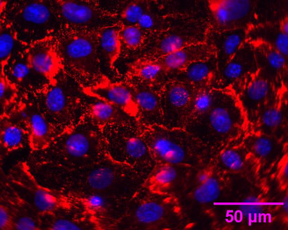 Immunfluoreszenz von West Nil Virus infizierten Zellen